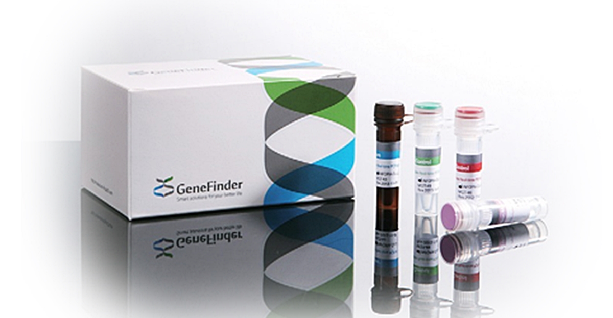 Covid 19 Bulgaria s Health Ministry To Buy 42 000 Real time PCR Tests The Sofia Globe
